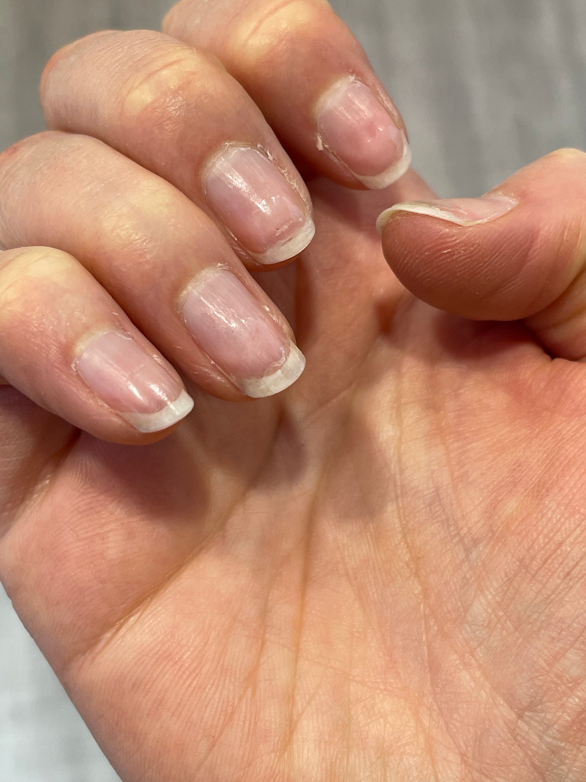 Close-up of a hand with nails that have a chipped or worn appearance.