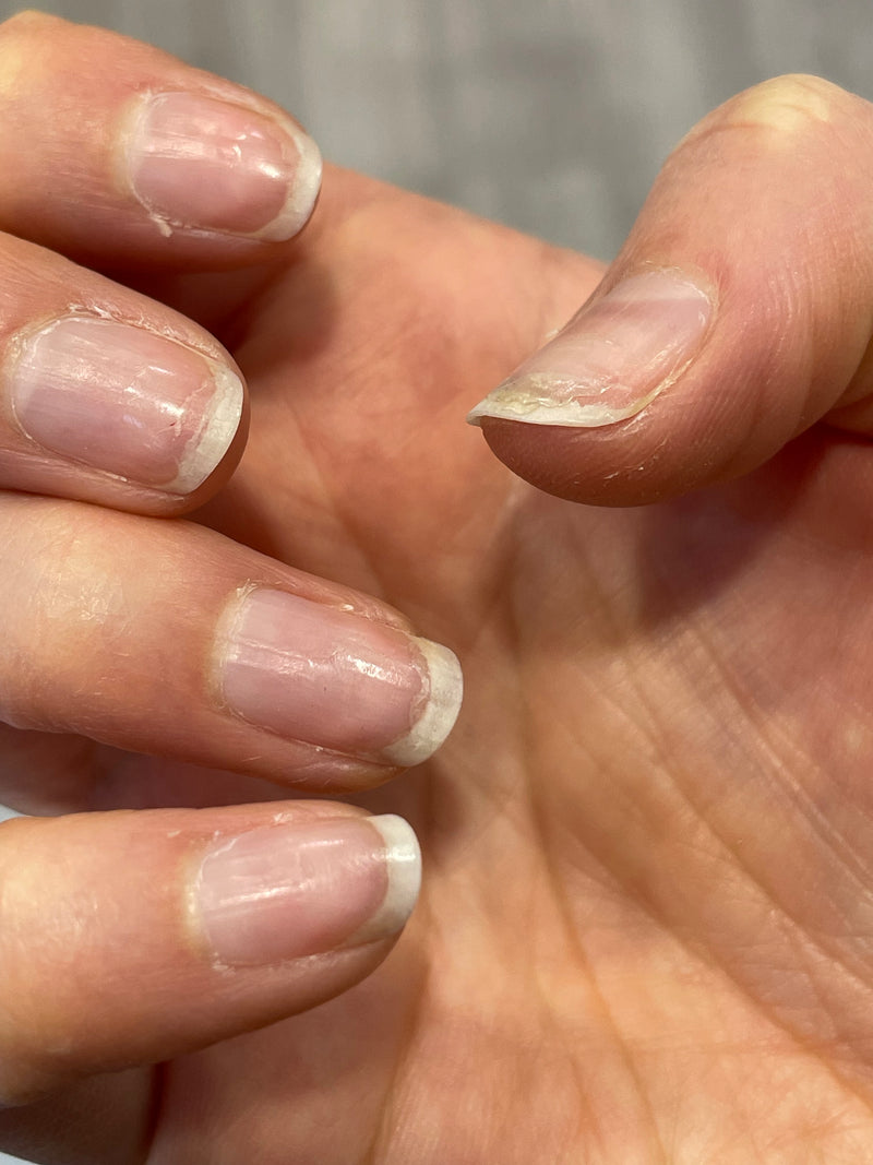 Before nail care results for Founder: Samantha (Olive)