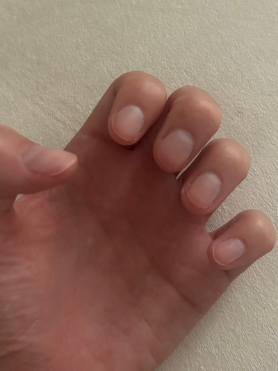 Before use